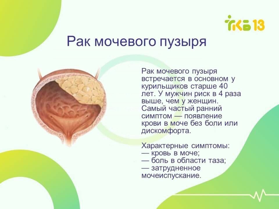 МРТ малого таза у мужчин (предстательная железа (простата), аденома простаты) MRI MRT