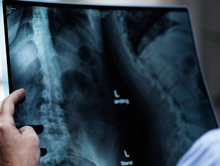 Международный день радиологии и День рентгенолога